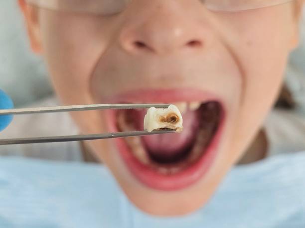 Best Emergency TMJ Treatment in Maria Stein, OH