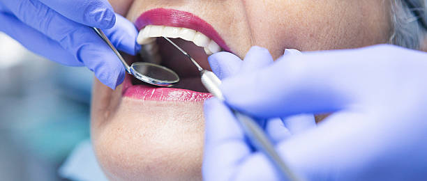 Best Emergency Gum Treatment in Maria Stein, OH